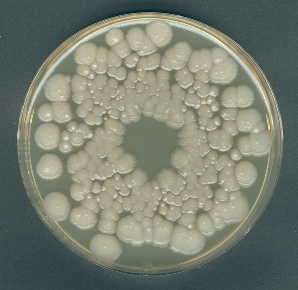 ORANGE-SERUM AGAR